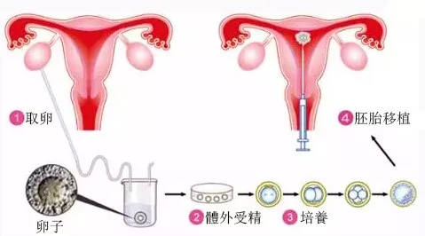 46岁做供卵试管婴儿的成功率并不低
