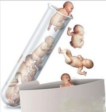 重庆借卵试管婴儿医院。做借卵试管婴儿的利与弊是什么？