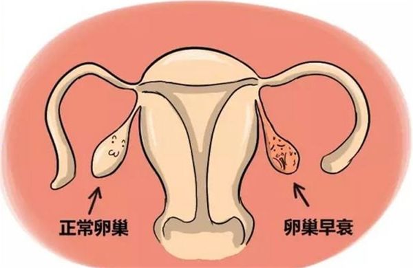 供卵试管婴儿的取卵和移植过程中会不会很疼？也许很多人都不知道