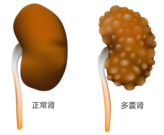 供卵做试管婴儿移植后的注意事项