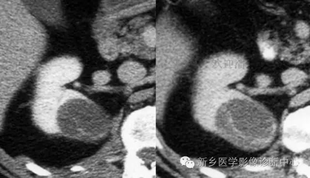 赠卵试管自怀真的都不是自己的孩子吗？