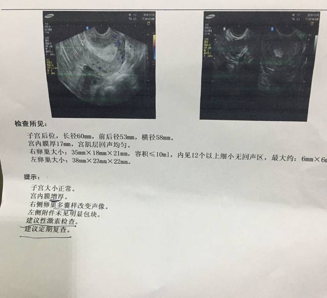 试管移植多久可以测出怀孕