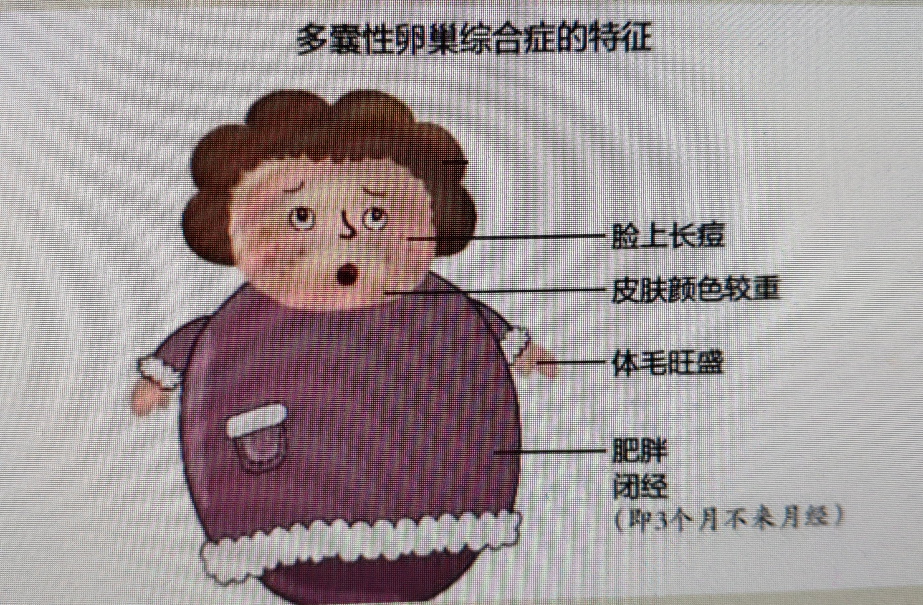 试管移植多久可以测出怀孕