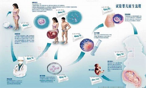 能生男孩的y精子分离人工授精在国内哪里可以做