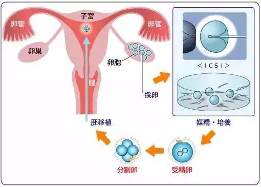 取卵后小腹很痛怎么办（取卵后小腹胀痛怎么办）