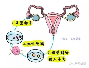 特纳综合症能生育吗（“赠卵”试管代怀最好的医院或是选择之一）