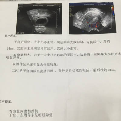 重庆哪个医院代怀代生孩子婴儿成功率最高