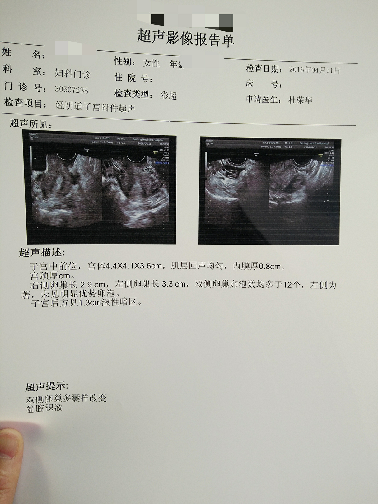 重庆哪个医院代怀代生孩子婴儿成功率最高