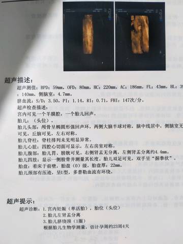 2024重庆第三代代怀条件医院排行榜费用需要多少钱