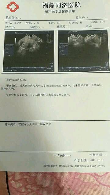 重庆代生价格明细婴儿的全部流程是怎样的